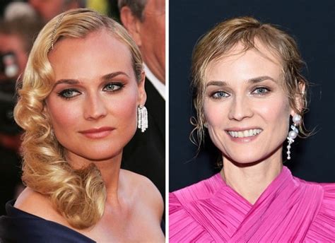 diane kruger breast implants|Diane Kruger Before and After Plastic Surgery: Boob,。